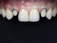 /album/chytra-preparace-overene-postupy-pro-kazdodenni-praxi/thumbnail-1-001-jpg/