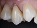 /album/chytra-preparace-overene-postupy-pro-kazdodenni-praxi/thumbnail-3-001-jpg/