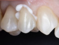 /album/chytra-preparace-overene-postupy-pro-kazdodenni-praxi/thumbnail-4-001-jpg/