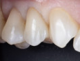 /album/chytra-preparace-overene-postupy-pro-kazdodenni-praxi/thumbnail-5-001-jpg/