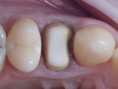 /album/chytra-preparace-overene-postupy-pro-kazdodenni-praxi/thumbnail-6-001-jpg/